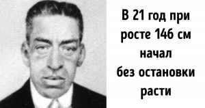 Невигадана історія чоловіка, який народився карликом, а помер гігантом